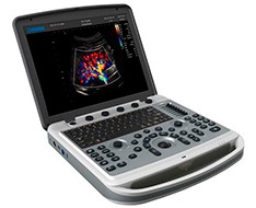 Chison SonoBook Ultrasound Machine