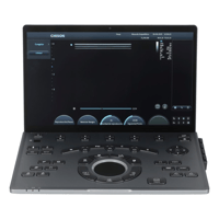 Chison SonoAir 70 Portable Ultrasound Machine