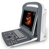 Chison ECO2 Portable Ultrasound System