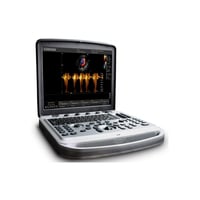 Chison Sonobook 8 portable ultrasound system with a choice of probes - USED