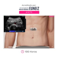 WAZO CAMPUS: Online Course in Abdominal Ultrasound. Official university certificate issued by the University of Vitoria-Gasteiz (EUNEIZ)