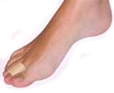 Protections and templates of silicone and gel