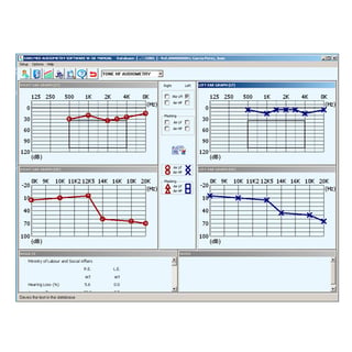 Sibelmed W5O software for Sibelmed 400 audiometer