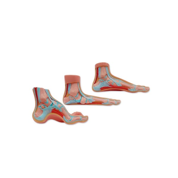 Realistic foot exposure (flat, normal and cavus)