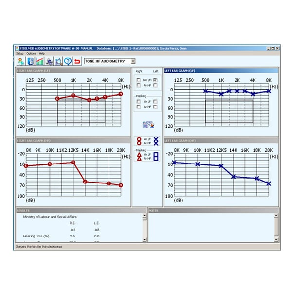 Sibelmed W5O software for Sibelmed 400 audiometer