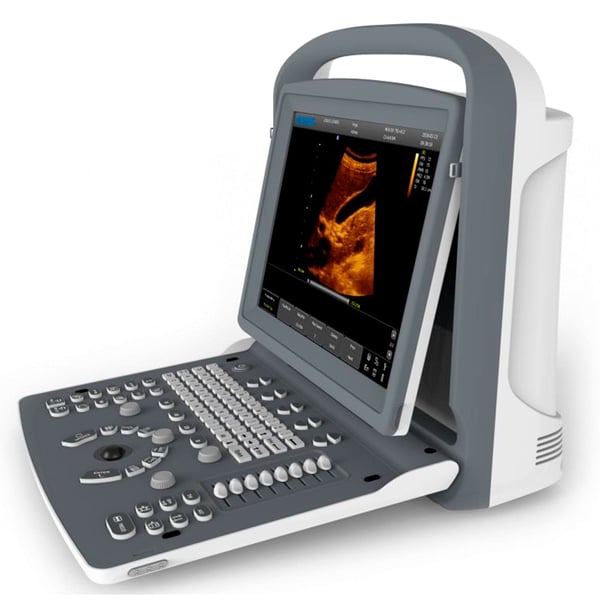 Chison ECO2 Portable Ultrasound System