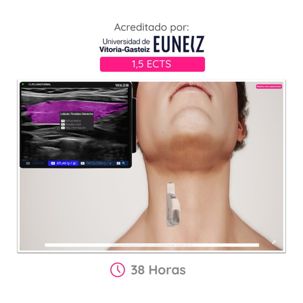 WAZO CAMPUS: Online Course in Cervical Ultrasound of the Neck and Thyroid. Official university certificate issued by the University of Vitoria-Gasteiz (EUNEIZ)