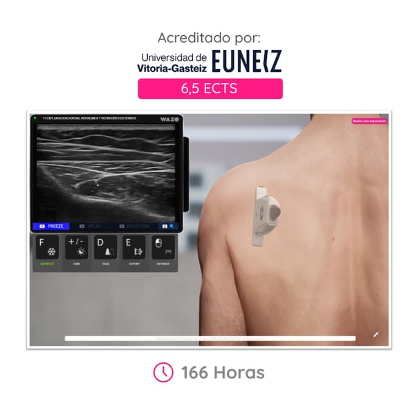 WAZO CAMPUS: Online Musculoskeletal Course. Official university certificate issued by the University of Vitoria-Gasteiz (EUNEIZ)