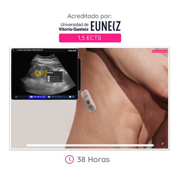 WAZO CAMPUS: Online Breast Ultrasound Course. Official university certificate issued by the University of Vitoria-Gasteiz (EUNEIZ)