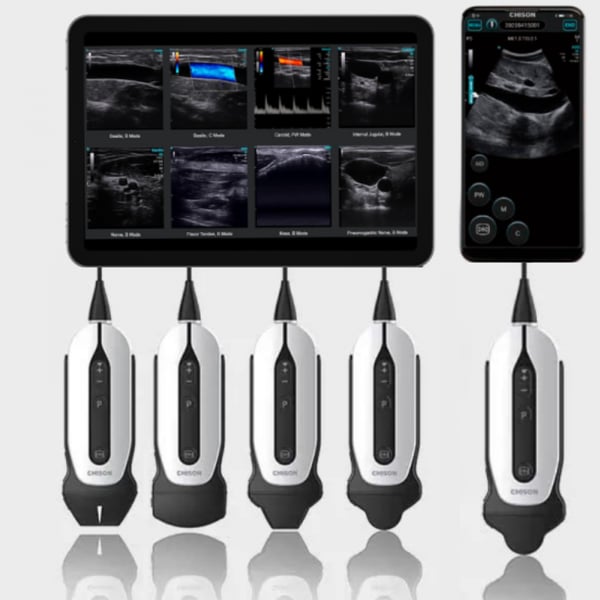 Chison SonoEye Portable Ultrasound System: P3 phased array probe, SONOEYE P5 convex probe and SONOEYE P6 micro convex probe:
