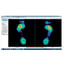 Biomechanical pressures platform Gait analysis 3D Pedistar Includes gateway Gift!