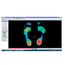 Biomechanical pressures platform Gait analysis 3D Pedistar Includes gateway Gift!