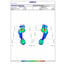 Biomechanical pressures platform Gait analysis Pedistar 3D Pro Includes gateway gift!