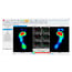Biomechanical pressures platform Gait analysis Pedistar 3D Pro Includes gateway gift!