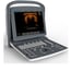 Chison ECO 2 Portable Ultrasound with 11MHz Linear Probe: better performance with battery included and Spectral Doppler