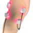 LaserPatch 650: modular system for laser therapy and laser acupuncture LaserPatch 650: modular system for laser therapy and laser acupuncture