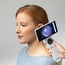 Digital diagnostic camera: RCS-100 Riester with interchangeable lenses acts as an otoscope, dermatoscope, general lens and endoscopy adapter