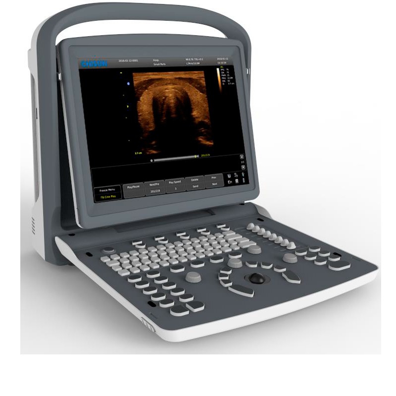 Chison eco 2 portable ultrasound with 10mhz linear probe better