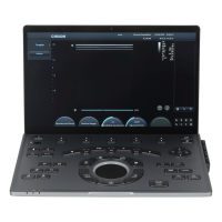 Chison SonoAir 70 Portable Ultrasound Machine Chison SonoAir 70 Portable Ultrasound Machine