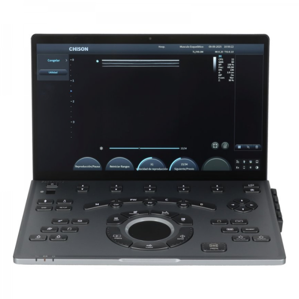 Chison SonoAir 70 Portable Ultrasound Machine Chison SonoAir 70 Portable Ultrasound Machine