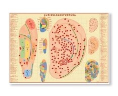 Prints of Auriculopuncture Prints of Auriculopuncture