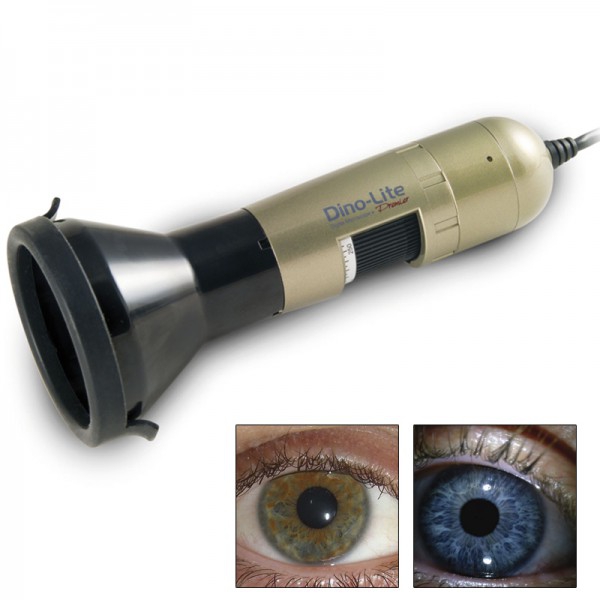 Dino-Lite Iriscope: Easily create sharp images of the eyes and irises Dino-Lite Iriscope: Easily create sharp images of the eyes and irises