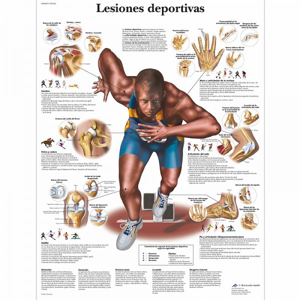 Anatomy Chart: Sports Injuries