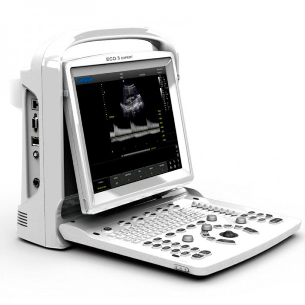 Chison ECO3 Expert portable ultrasound machine