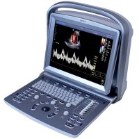 Chison ECO5 Portable Ultrasound Machine