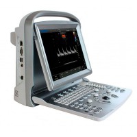 Chison ECO6 Portable Ultrasound Machine