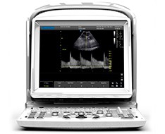 Chison ECO ultrasound machines Chison ECO ultrasound machines