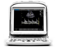 Chison ECO ultrasound machines