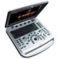 Chison Sonobook6 portable ultrasound machine