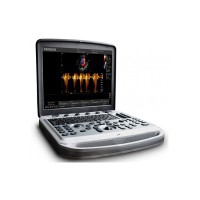 Chison Sonobook8 portable ultrasound machine