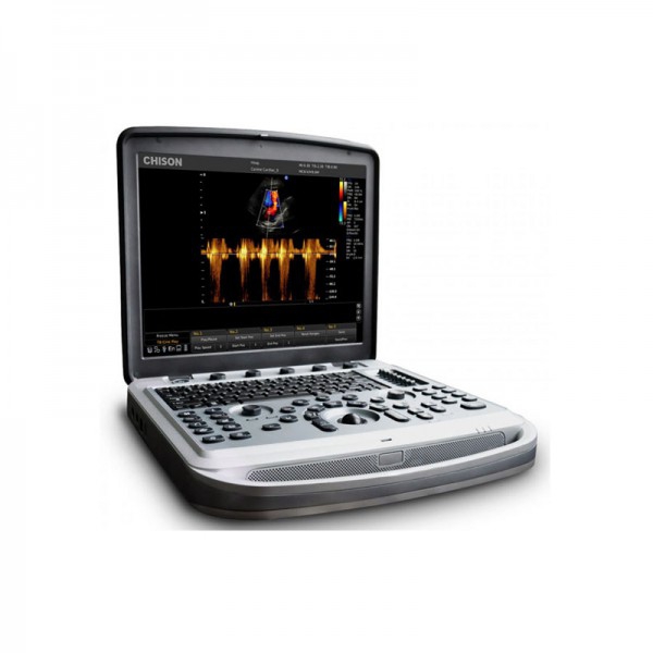 Chison Sonobook8 portable ultrasound machine Chison Sonobook8 portable ultrasound machine
