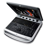 Chison Sonobook9 portable ultrasound machine