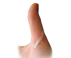 Wound closure Wound closure