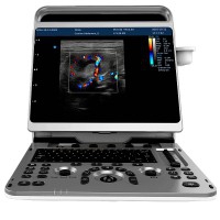 Chison EBit30 portable ultrasound machine
