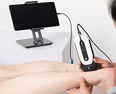 Chison Sonoeye ultrasound machines Chison Sonoeye ultrasound machines