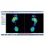 Biomechanical pressures platform Gait analysis 3D Pedistar Includes gateway Gift! Biomechanical pressures platform Gait analysis 3D Pedistar Includes gateway Gift!