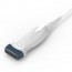 Portable Echograph Chison ECO 1 with 5.3-11 MHz Linear Probe: 12-inch black and white display Portable Echograph Chison ECO 1 with 5.3-11 MHz Linear Probe: 12-inch black and white display