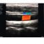 SonoStar Wireless Portable Ultrasound: Color Doppler, 10 MHz Linear Probe / 128 elements + Gift iPad! SonoStar Wireless Portable Ultrasound: Color Doppler, 10 MHz Linear Probe / 128 elements + Gift iPad!