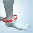 Equine Foot Splint: Used for drop foot deformity