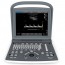 Portable Echograph Chison ECO 2 with 11MHz Linear Probe: better performance with included battery and Spectral Doppler Portable Echograph Chison ECO 2 with 11MHz Linear Probe: better performance with included battery and Spectral Doppler