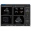 Chison ECO 2 Portable Ultrasound with 11MHz Linear Probe: better performance with battery included and Spectral Doppler