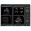 Portable Echograph Chison ECO 2 with 11MHz Linear Probe: better performance with included battery and Spectral Doppler Portable Echograph Chison ECO 2 with 11MHz Linear Probe: better performance with included battery and Spectral Doppler