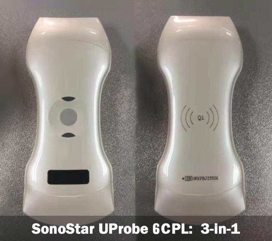 Up Robe Sonostar SonoStar UProbe 6CPL Ultrasound Scanner 3-in-1 wireless portable ...