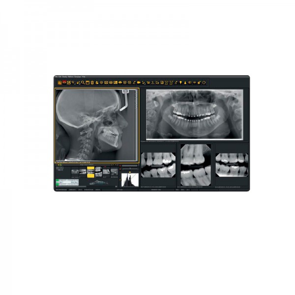 Mediadent: Dental Images Management Software